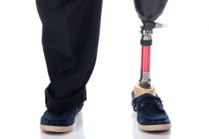 Amputation and Loss of Limbs Attorneys Mercer and Middlesex County NJ