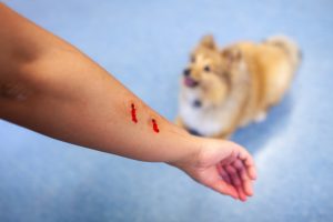 Recovering Compensation for Dog Bite Injuries in Mercer County