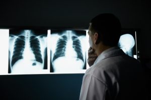 Radiology As Medical Malpractice Risk