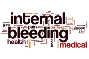 New Jersey Internal Bleeding Injury Lawyers 