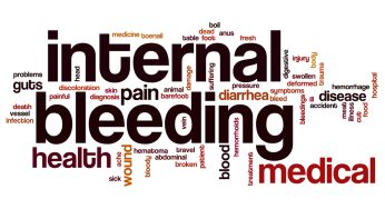 Internal Bleeding Injuries in NJ