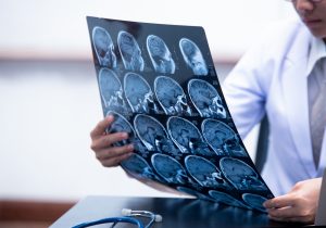 Traumatic Brain Injury Lawyers in Somerset County NJ