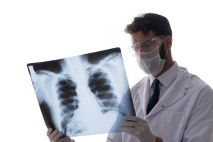 Asbestos-Related Diseases and How to Seek Compensation